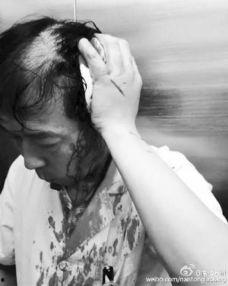 脑袋被打照片,惊心动魄的瞬间定格